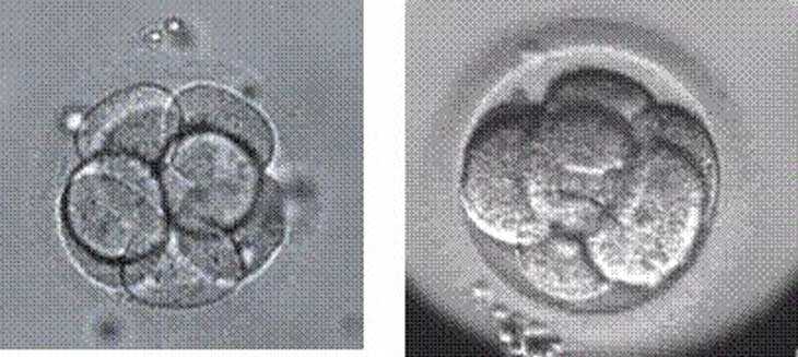做代孕前的检查_专业的合法代孕_西安姐妹试管婴儿科普|独家揭秘胚胎「选美」